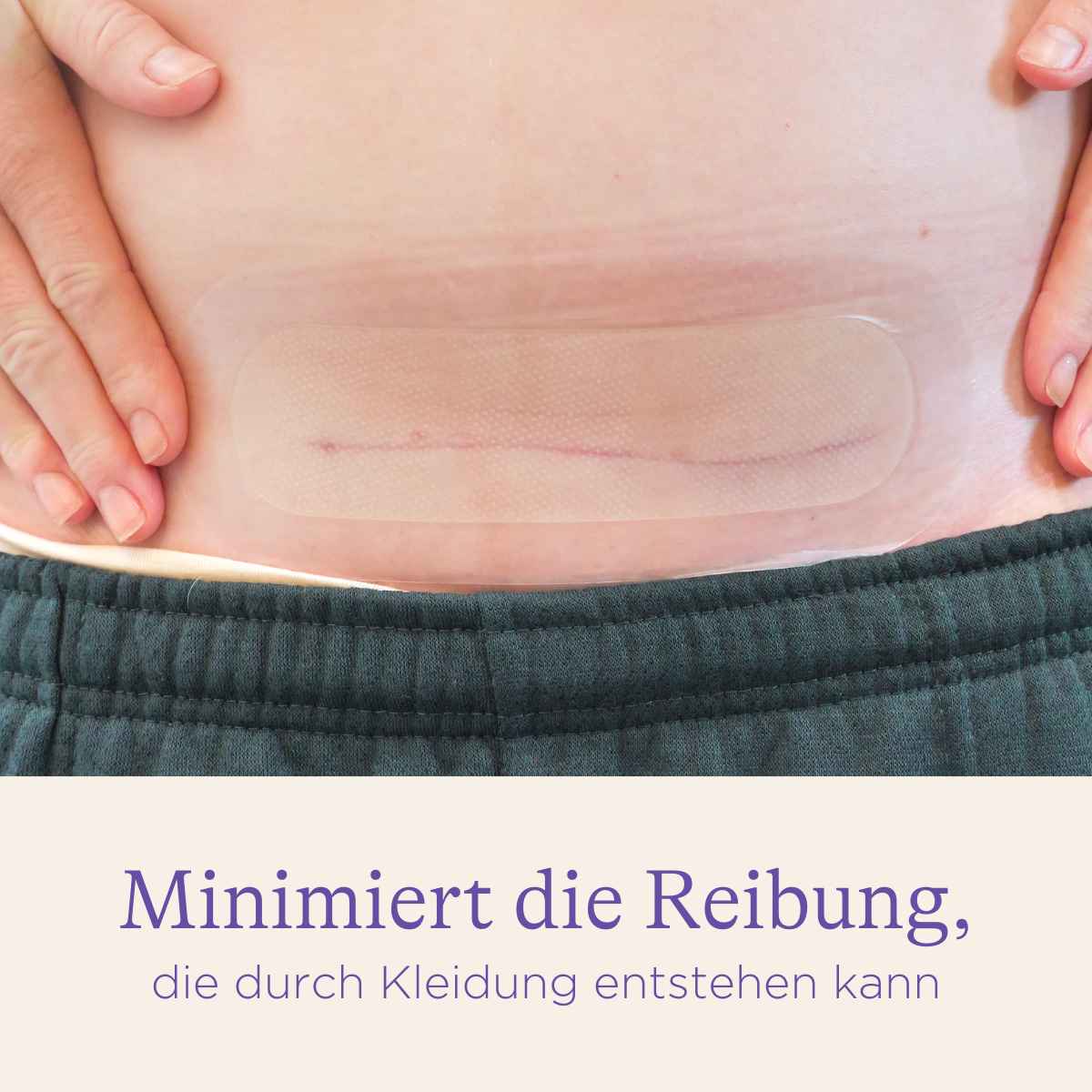 Kaiserschnitt-Hydrogel-Pads - Image 3